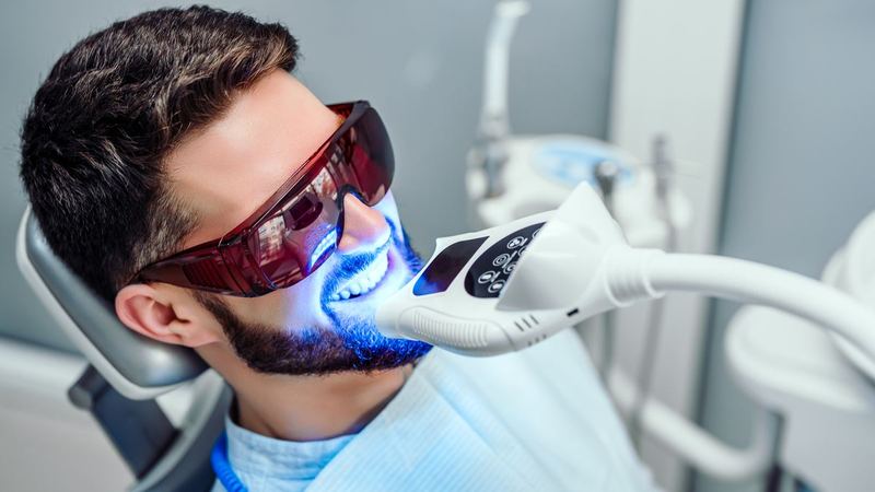 Professional Teeth Whitening: What Really Works