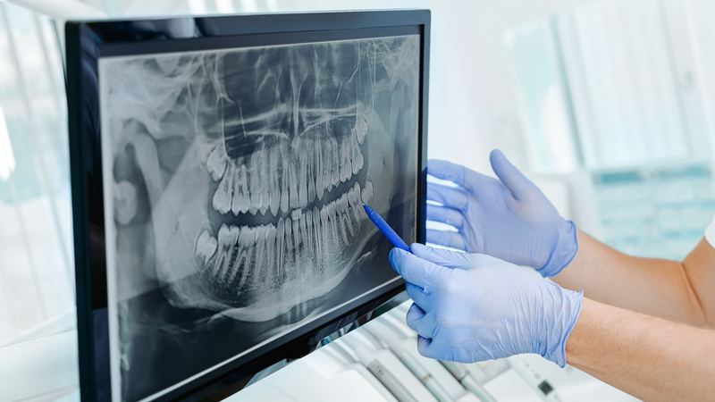 What to Expect From Oral Surgery: A Patient's Guide
