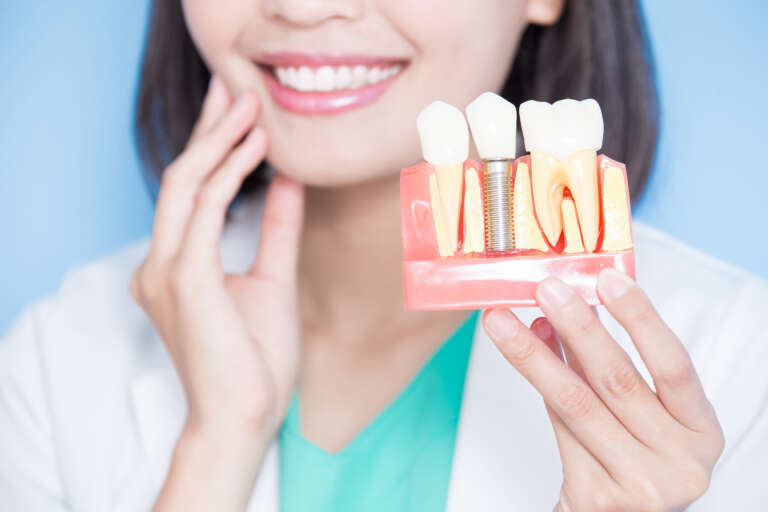 A Cosmetic Dentist’s Guide to Dental Implants in Metro Detroit